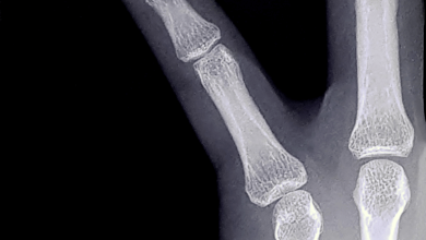 Pep en Frans als boeven in Amsterdam: 'Bijna pink kwijt'